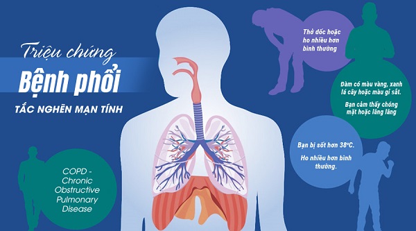 Bệnh phổi tắc nghẽn mạn tính có thể điều trị ổn định