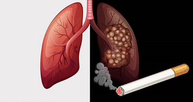 Hút thuốc lá khiến phổi bị nhiễm độc