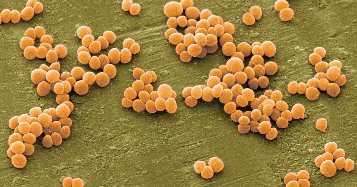 Tỳ bà diệp giúp ức chế sự hoạt động của Staphylococcus aureus