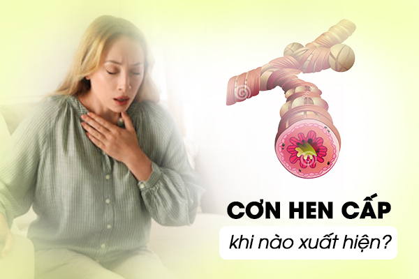 Cơn hen cấp khi nào xuất hiện?