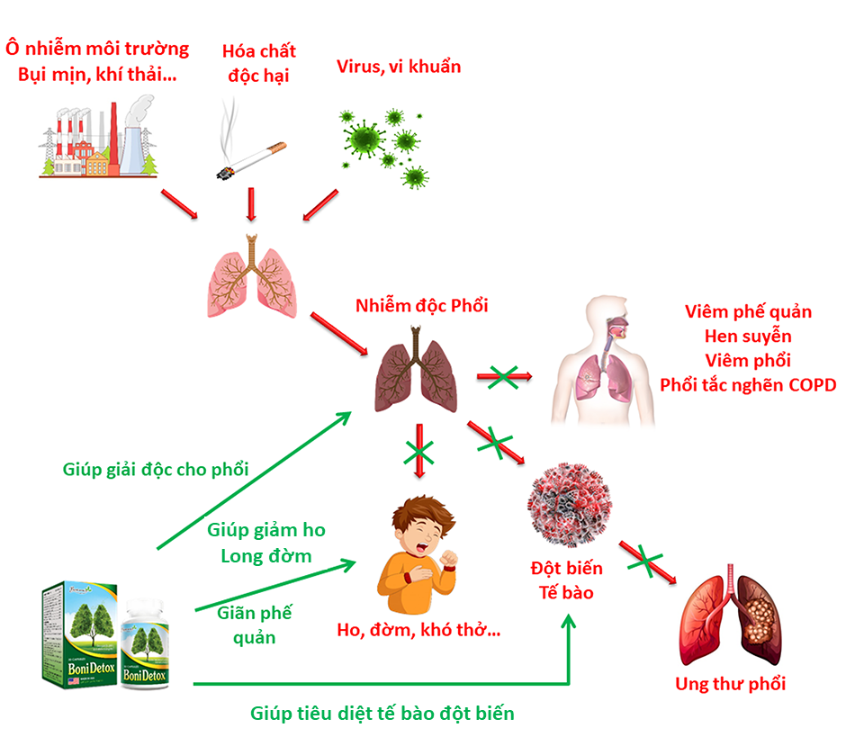 BoniDetox là giải pháp hoàn hảo cho lá phổi của bạn