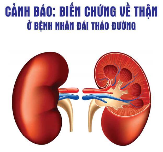 Cảnh báo biến chứng bệnh thận do đái tháo đường