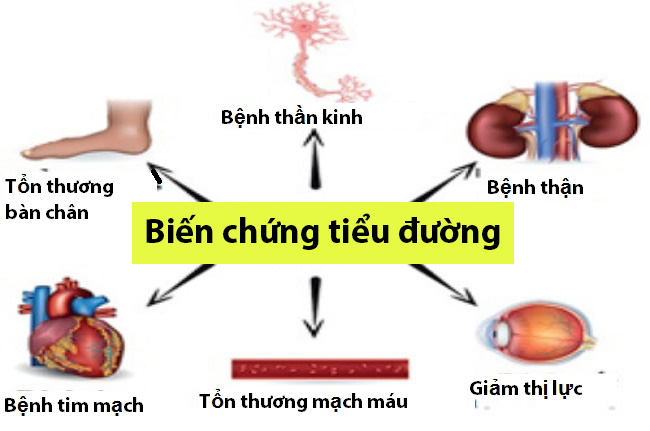 Bệnh tiểu đường tiềm ẩn nhiều biến chứng nguy hiểm khác nhau