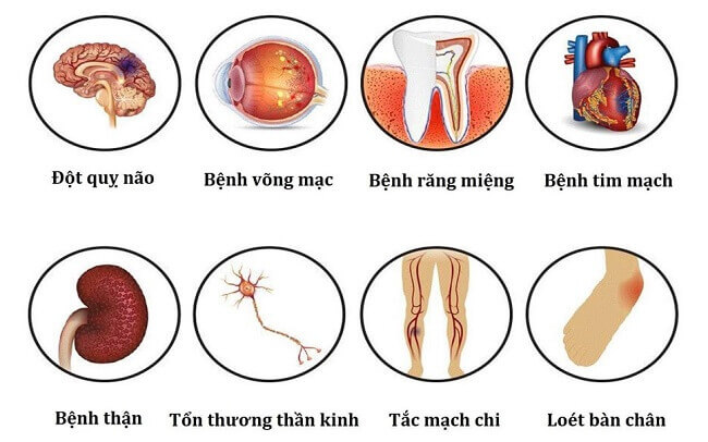 Bệnh tiểu đường có thể gây ra nhiều biến chứng nguy hiểm