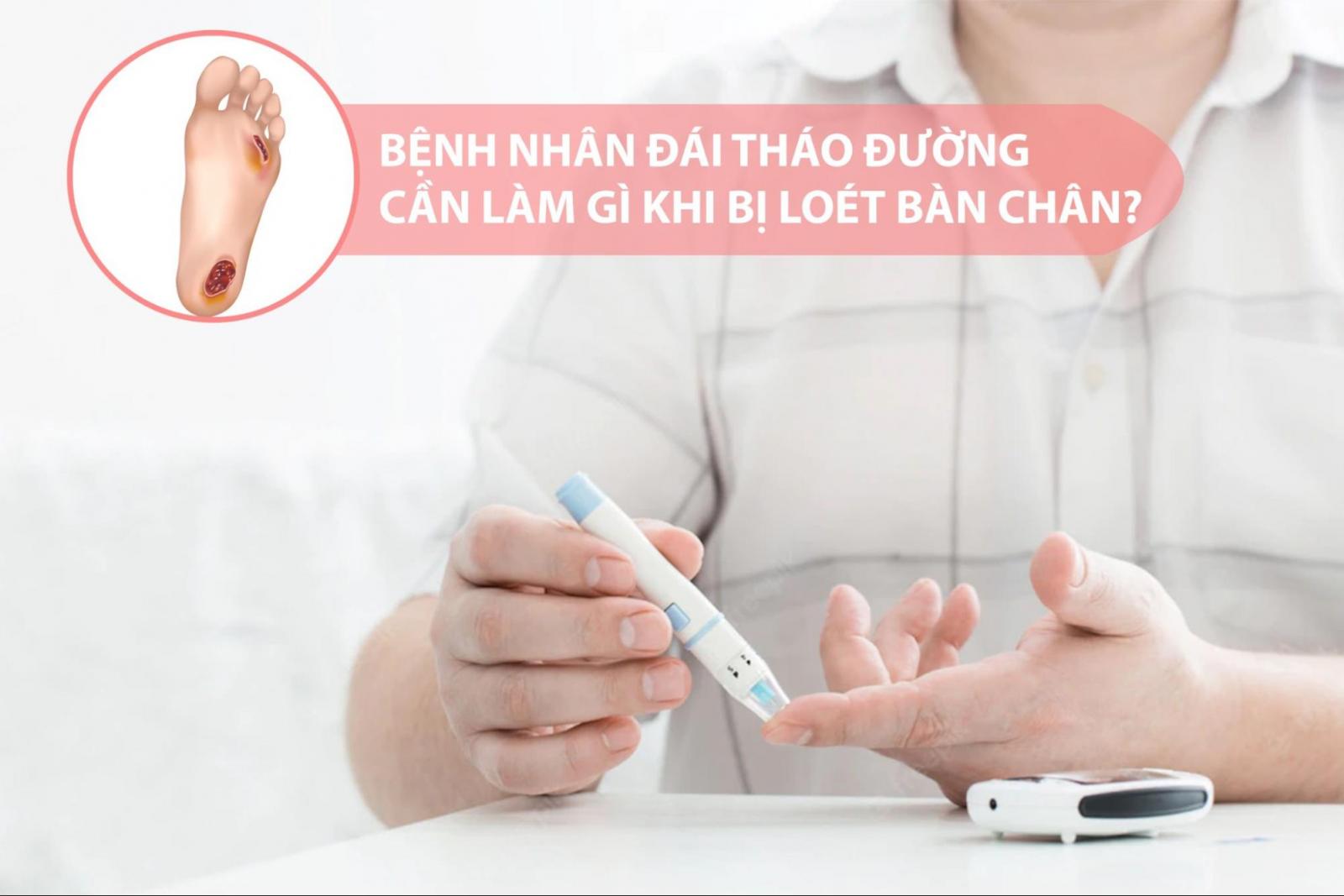 Cần làm gì khi bị biến chứng loét bàn chân?