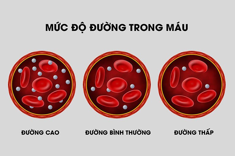 Lượng đường trong máu cao tạo điều kiện thuận lợi cho vi khuẩn phát triển gây nhiễm trùng và lở loét