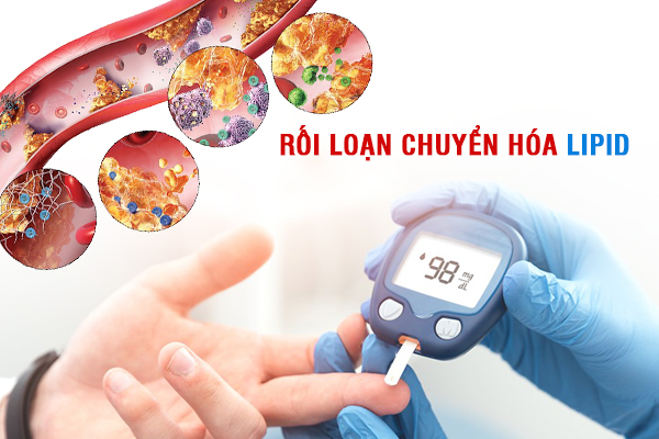 Rối loạn chuyển hóa lipid máu dẫn tới xơ vữa động mạch