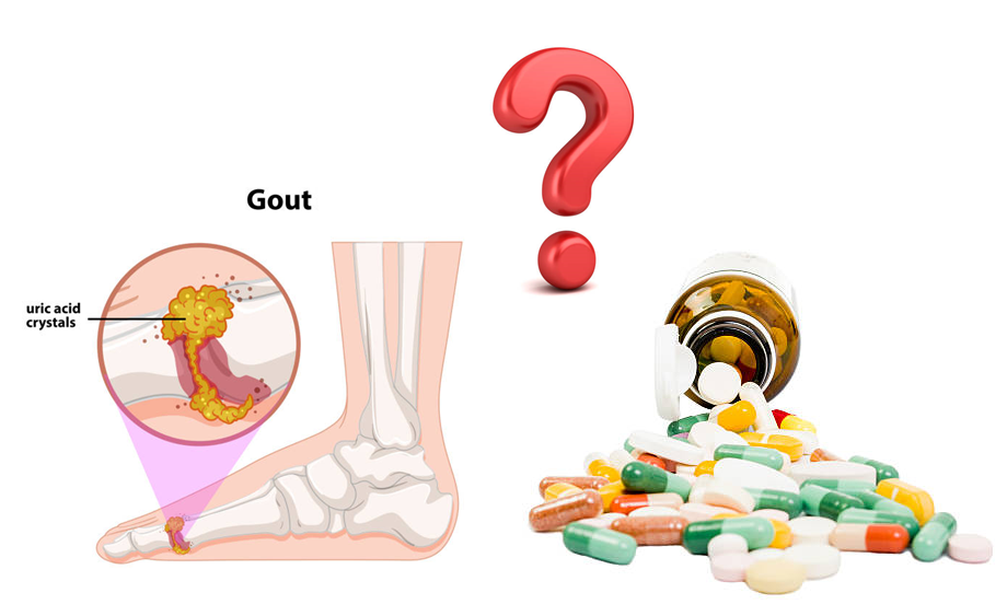 Bệnh gút uống thuốc gì?