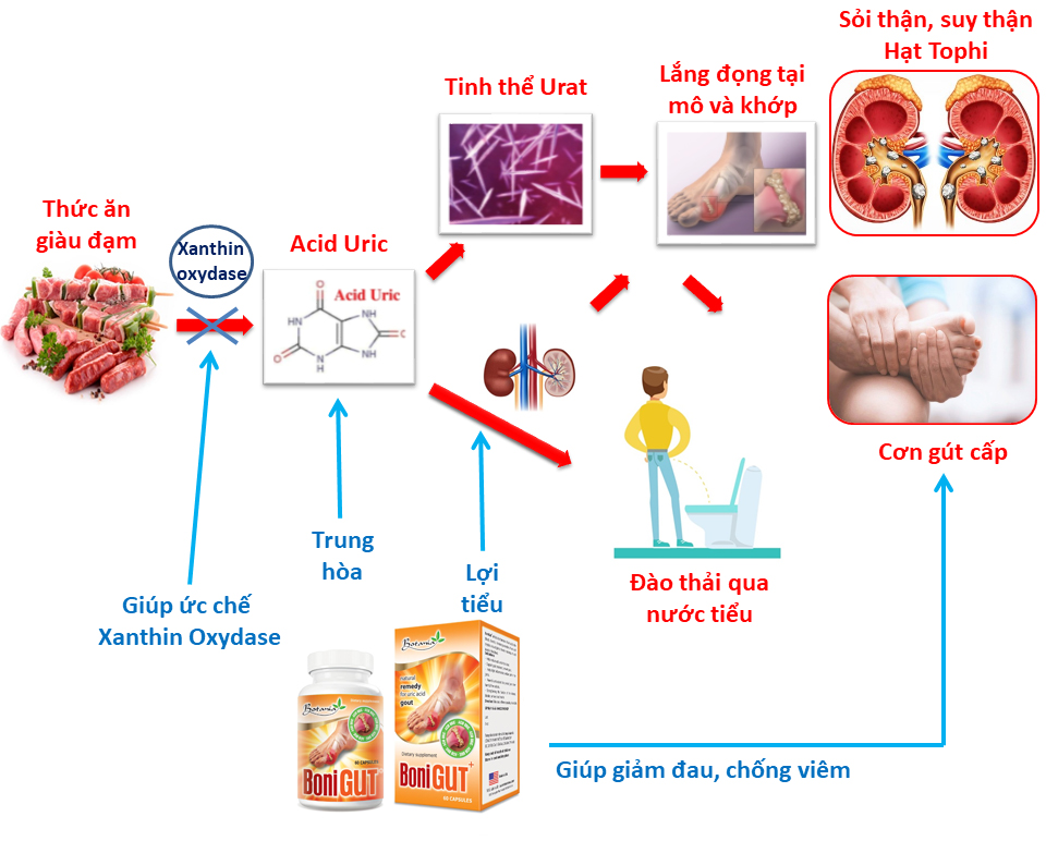 BoniGut + là sản phẩm có cơ chế tác dụng toàn diện hàng đầu hiện nay cho người bệnh gout