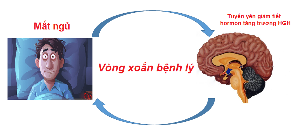 Mất ngủ và sự thiếu hụt hormon tăng trưởng HGH tạo thành vòng xoắn bệnh lý rất khó điều trị