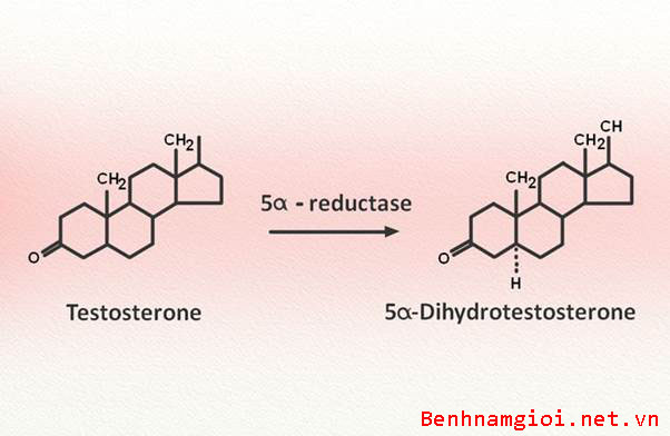 Sự tăng tiết Enzyme 5-alpha reductase chính là nguyên nhân gây u xơ tiền liệt tuyến