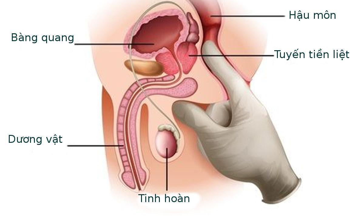 Thăm khám trực tràng bằng ngón tay có độ nhạy thấp