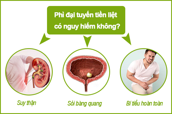 Phì đại tuyến tiền liệt có nguy hiểm không?