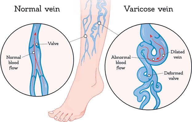 Kết quả hình ảnh cho vein