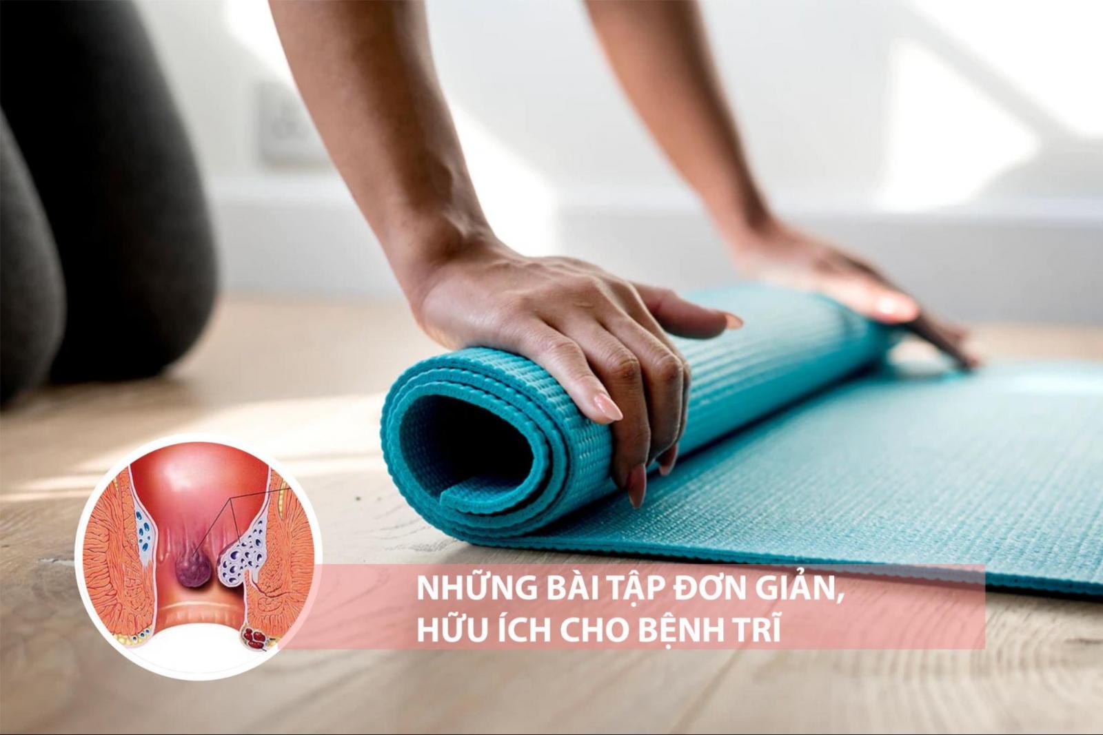 Bệnh trĩ nên tập luyện như thế nào?