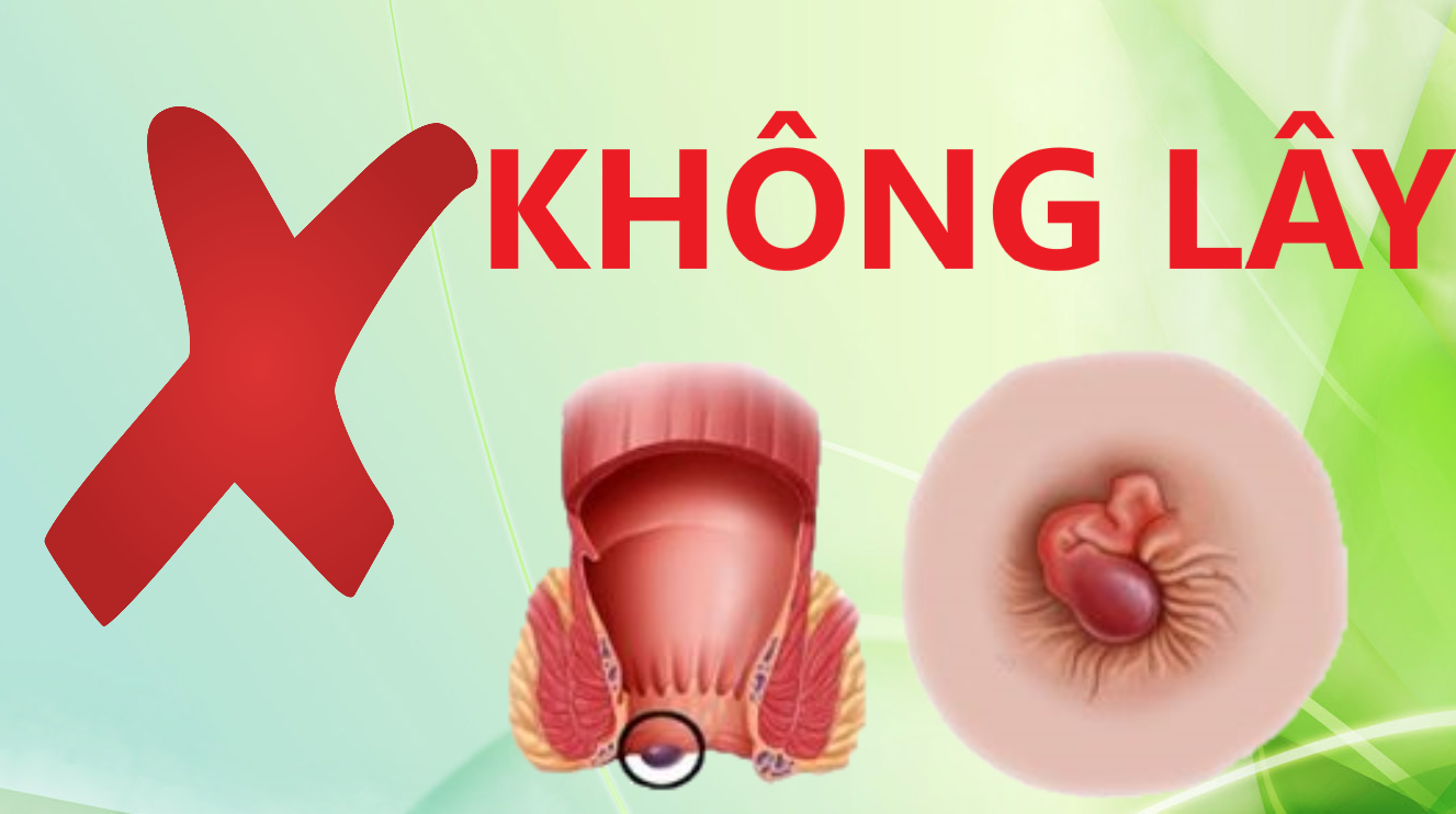 Bệnh trĩ không lây nhiễm