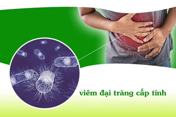 Biện pháp nào giúp phòng ngừa viêm đại tràng cấp tính?