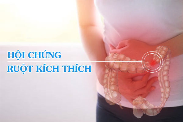 Đâu là cách phòng ngừa hội chứng ruột kích thích?