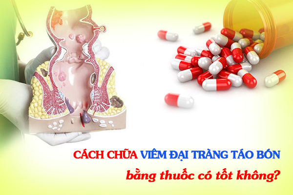 Cách chữa viêm đại tràng táo bón bằng thuốc có tốt không?