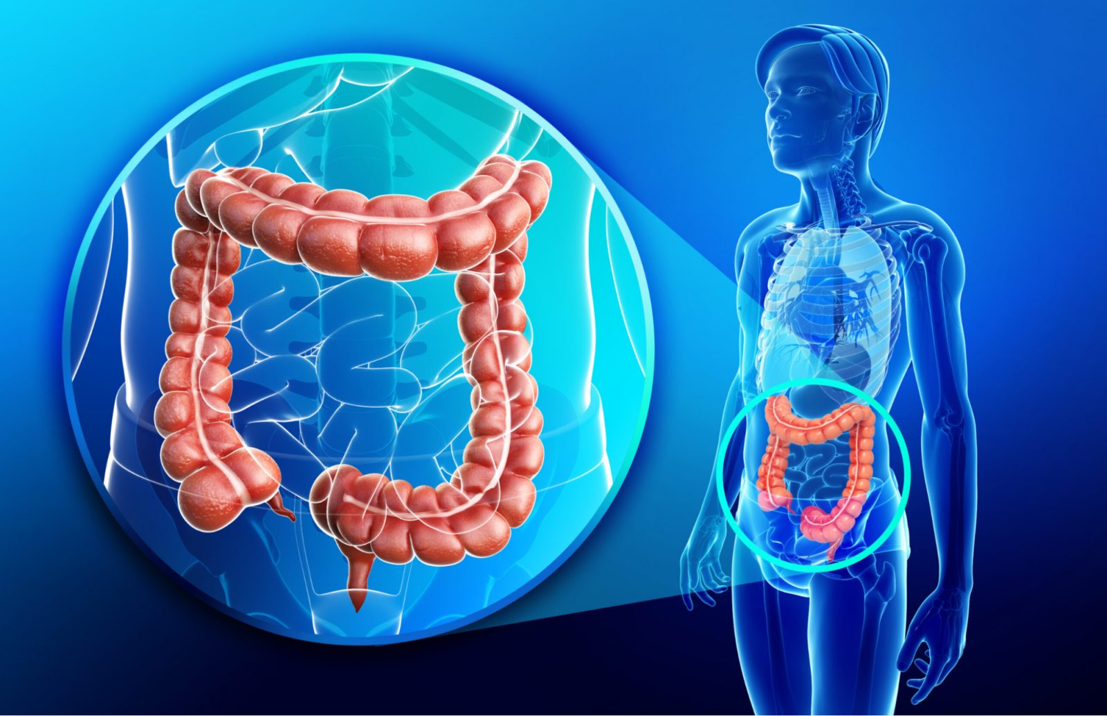 Viêm loét đại tràng có di truyền không?