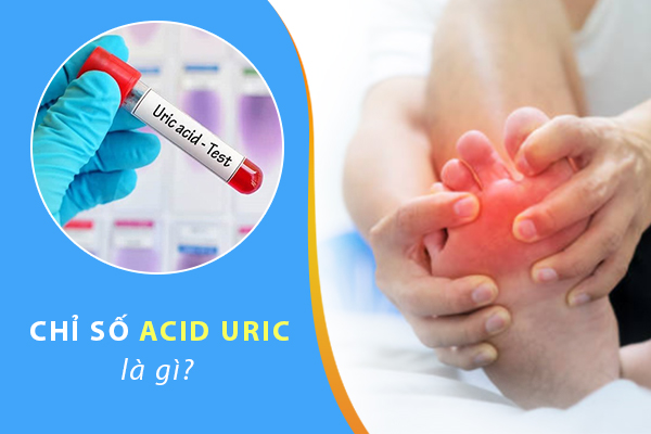 Chỉ số acid uric là gì?