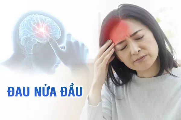 Chứng đau nửa đầu