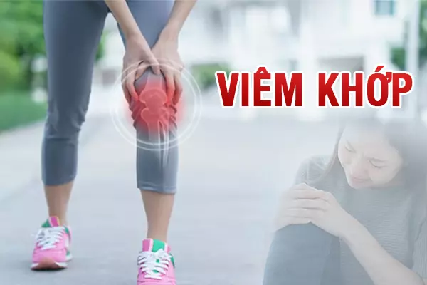 Viêm khớp