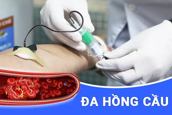 đa hồng cầu