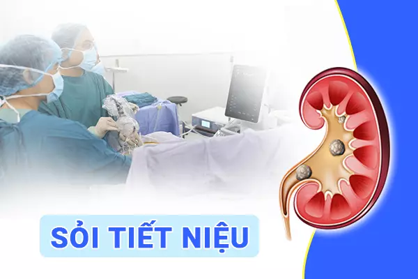 Sỏi thận, sỏi tiết niệu: Phương pháp nào giúp điều trị dứt điểm?