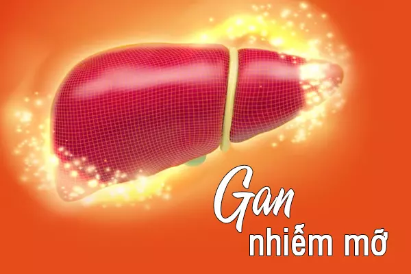 gan nhiễm mỡ