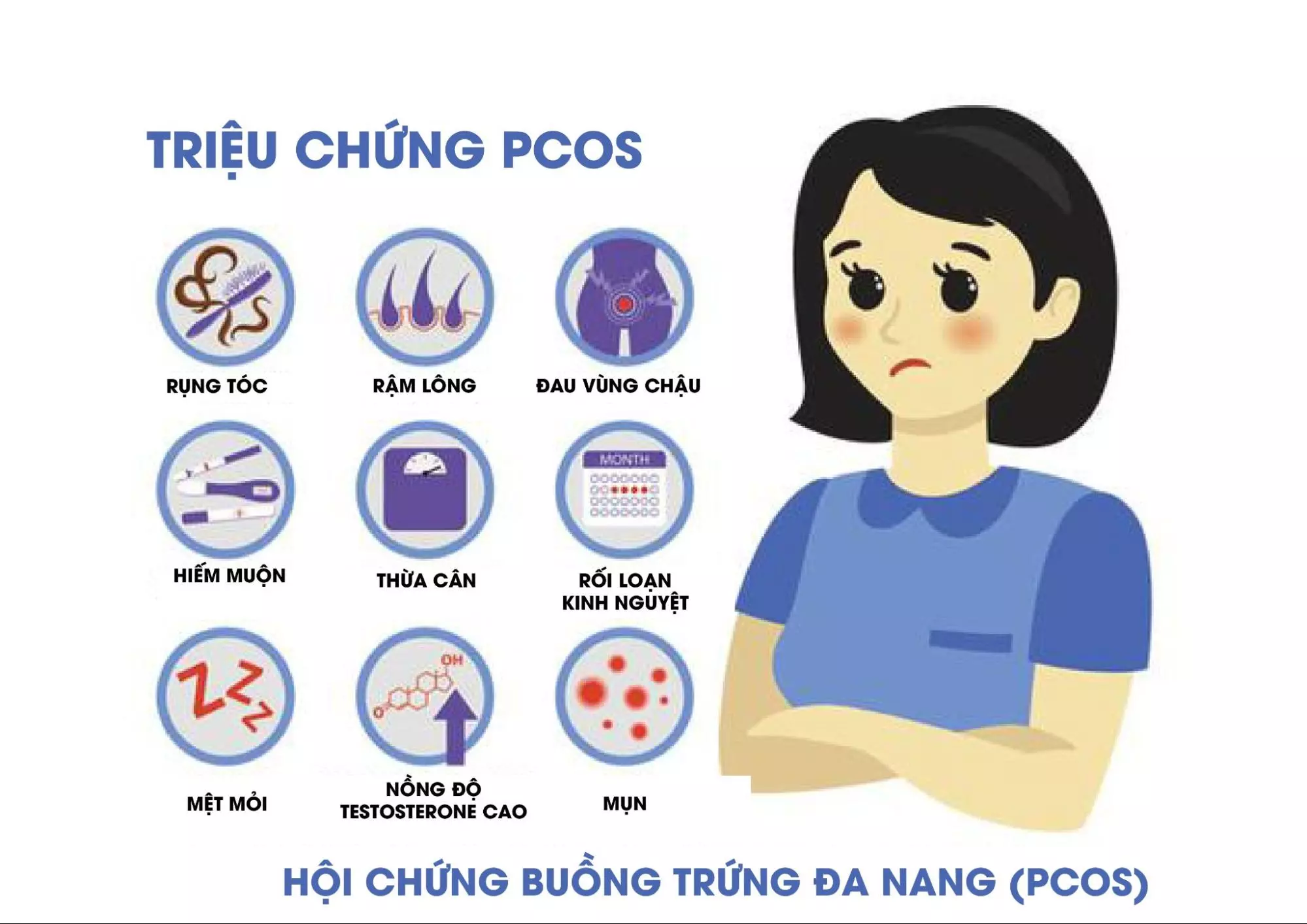 Các triệu chứng của PCOS