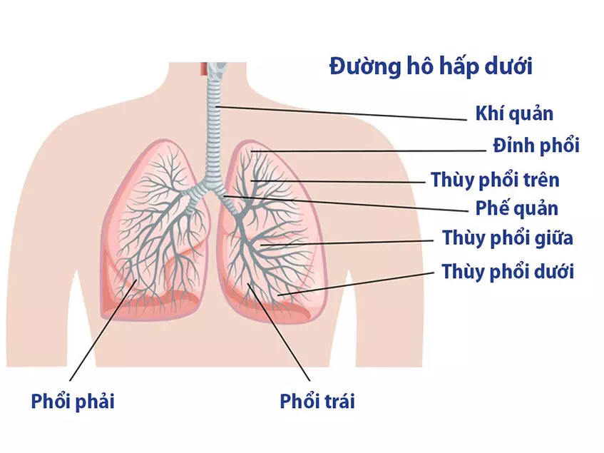 Điểm danh các nguyên nhân gây viêm đường hô hấp dưới và cách phòng ngừa