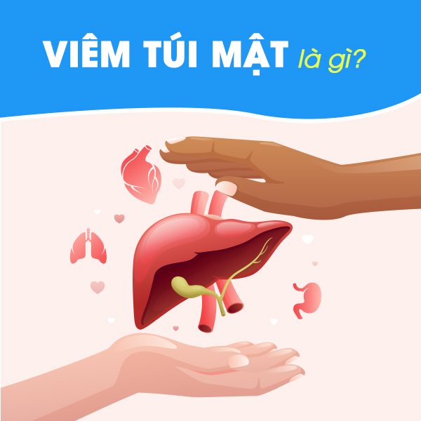 Viêm túi mật: Nguyên nhân, triệu chứng và cách điều trị