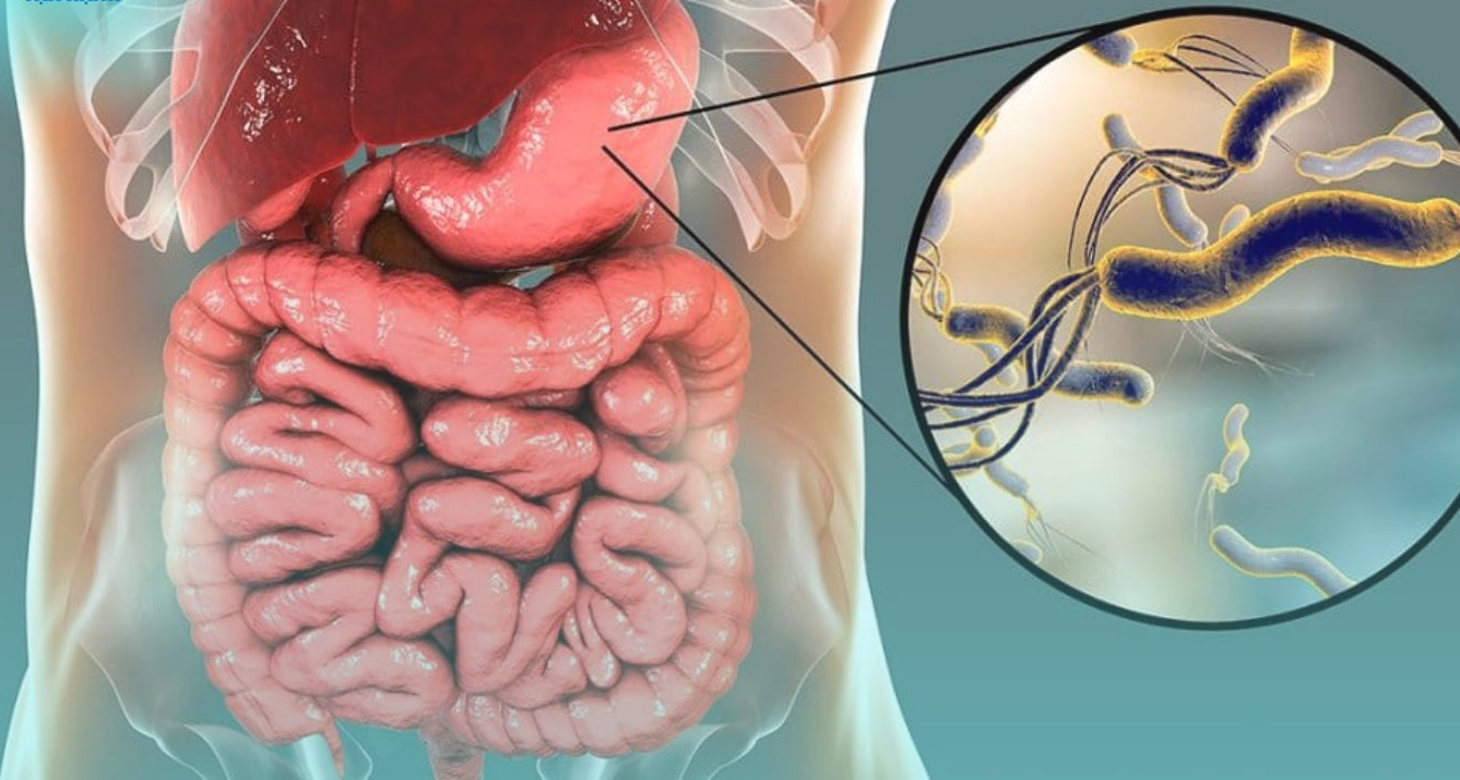 Vi khuẩn HP là sinh vật duy nhất sinh sống được trong dạ dày