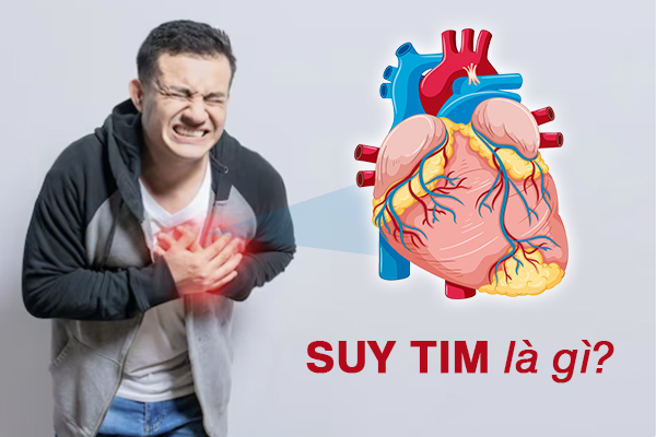 Suy tim là gì