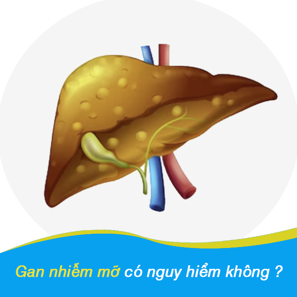 Gan nhiễm mỡ có nguy hiểm không?