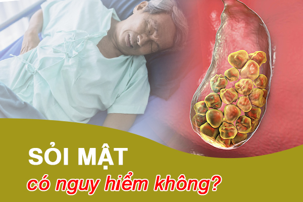 Sỏi mật có nguy hiểm không?