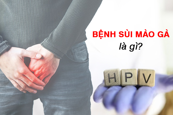 Bệnh sùi mào gà là gì?