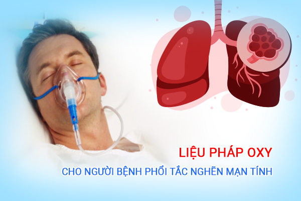 Tìm hiểu liệu pháp oxy cho người bệnh phổi tắc nghẽn mạn tính COPD