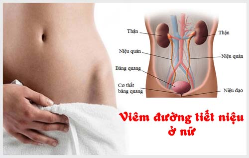 tổng quan về viêm đường tiết niệu ở nữ giới