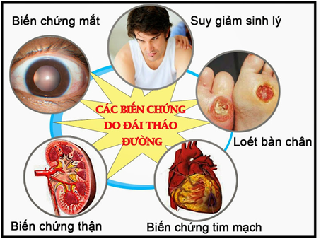 5 bộ phận bị ảnh hưởng nhiều nhất khi mắc bệnh tiểu đường 