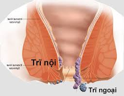 Hỏi: Dùng BoniVein cho bệnh trĩ bao lâu có tác dụng?