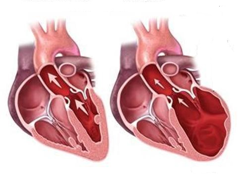 Những bệnh dễ lẫn với gút